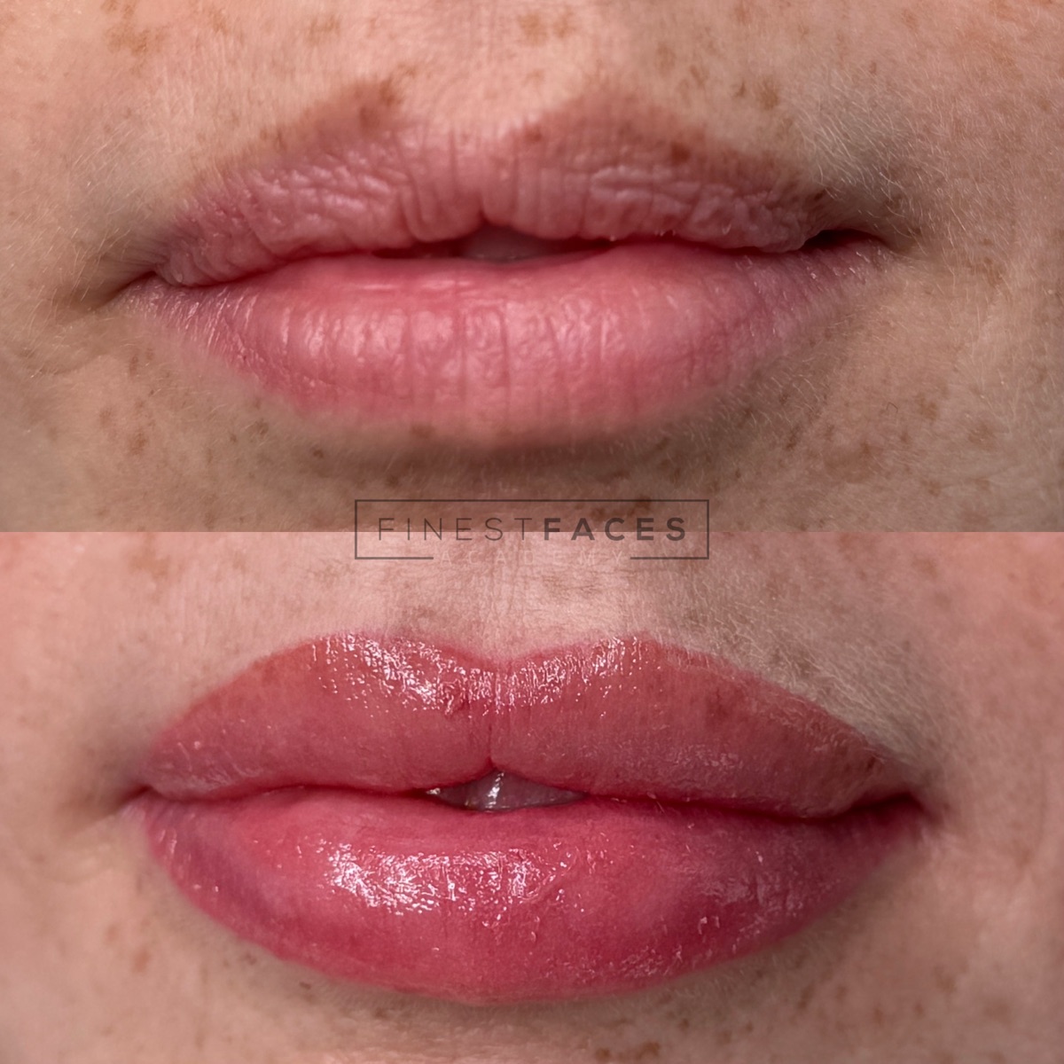 Aquarell Lips – Ergebnis von Finest Faces Bremen